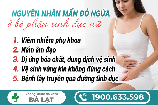 Hình ảnh minh họa